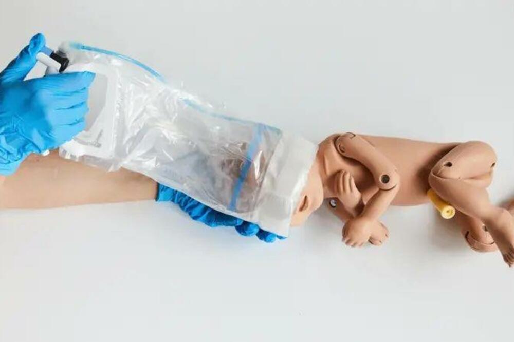 Foto: NHS North Bristol Trust/MNHI