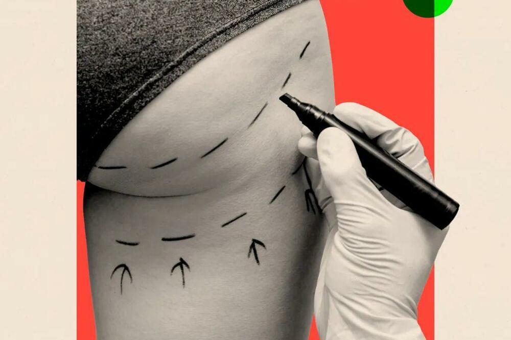 Foto: BBC