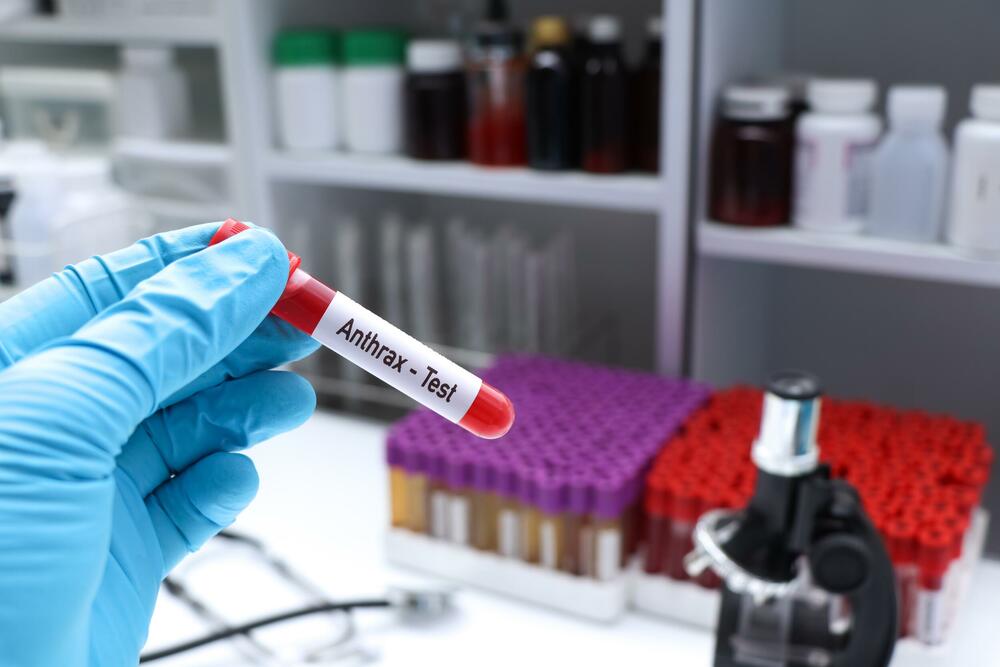Antraks se skladišti kao biološko oružje još od Drugog svjetskog rata