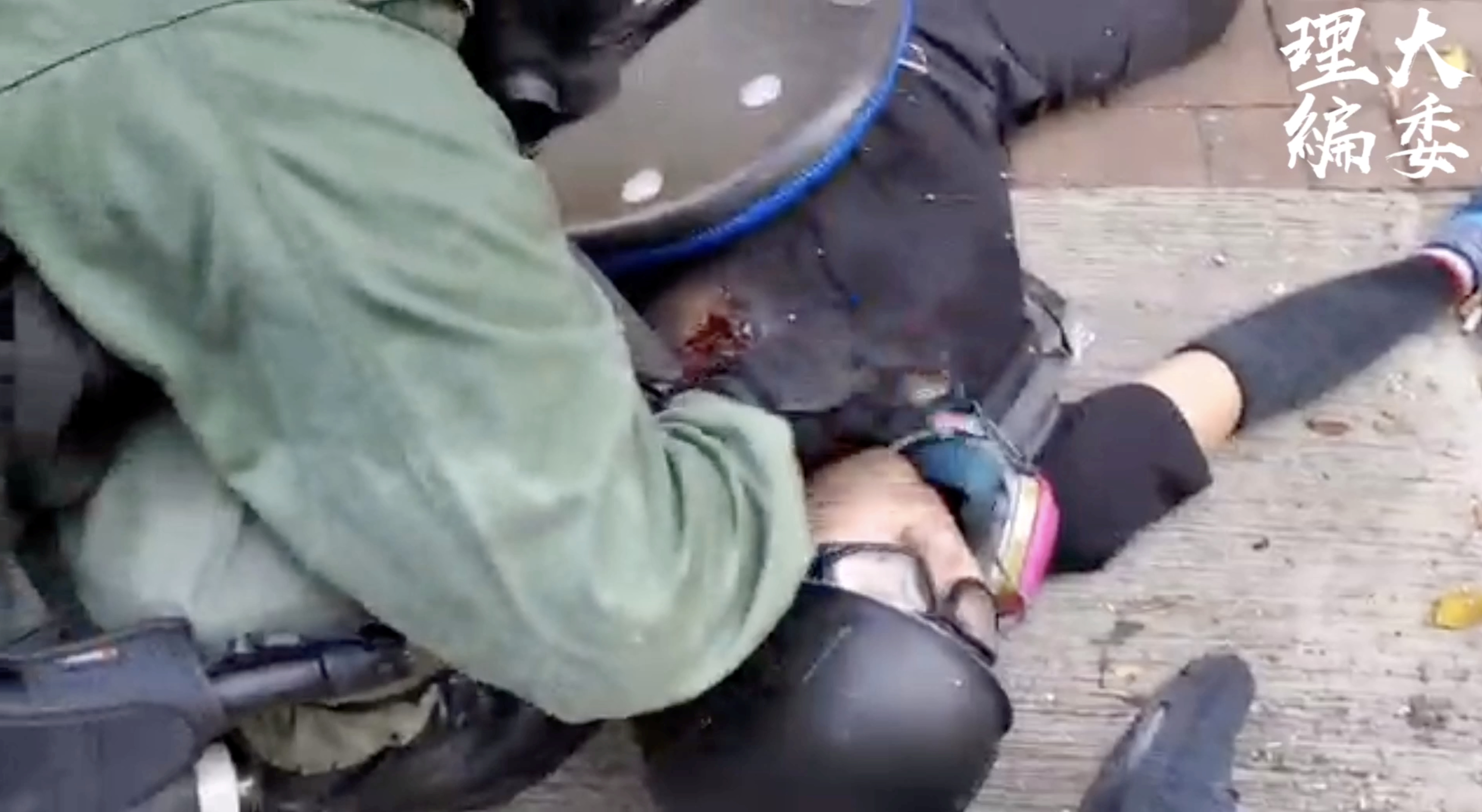 Pogođeni demonstrant