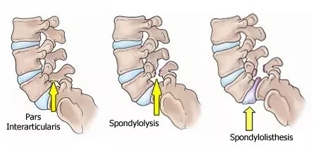 backbone